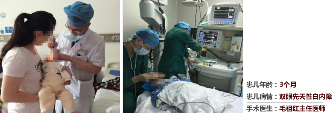 患兒年齡：3個月，患兒病情：雙眼先天性白內障，手術醫(yī)生：毛祖紅主任醫(yī)師