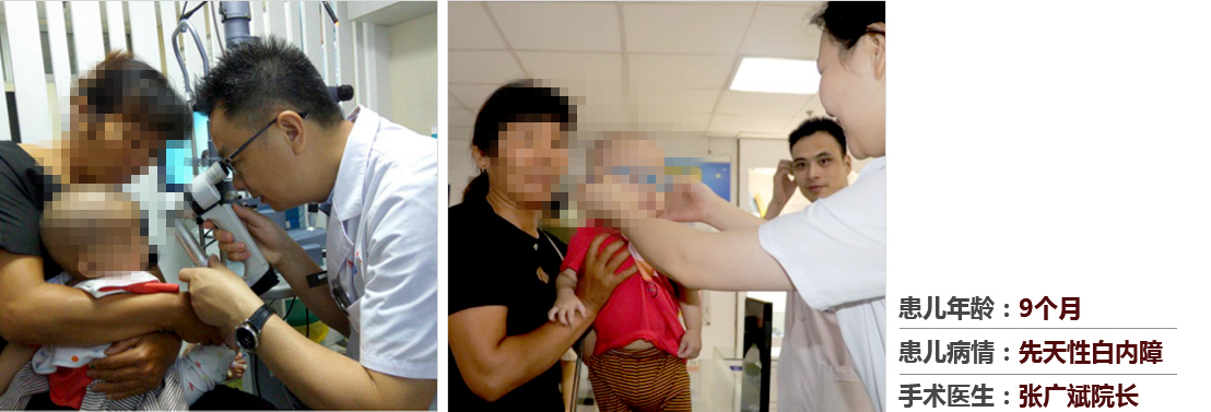 患兒年齡：9個月，患兒病情：先天性白內障，手術醫(yī)生：張廣斌院長