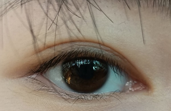 倒睫怎么辦？