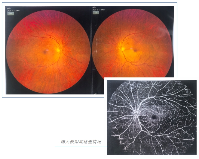 視網膜動脈阻塞